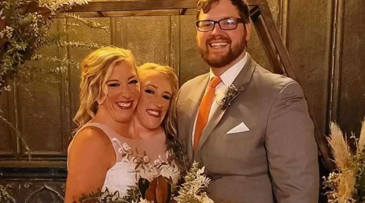 Gêmeas Siamesas Abby e Brittany Surpreendem ao Falar Sobre Gravidez