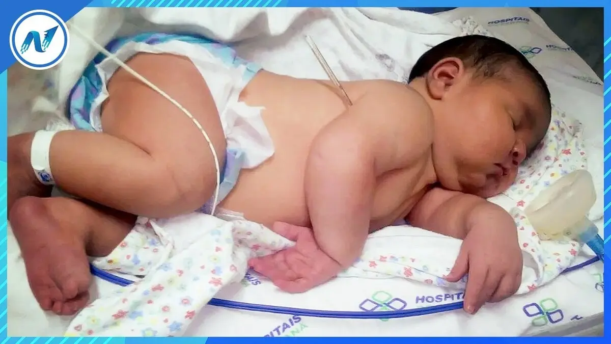 Macrossomia Fetal: O Que É, Causas, Riscos e Tratamento