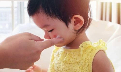 Picadas de Inseto em Bebês: Guia Prático para Proteger, Aliviar e Saber Quando Procurar Ajuda