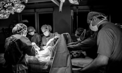 Cesariana: Entenda os Riscos e Quando o Procedimento é Realmente Necessário