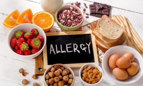 alergias alimentares